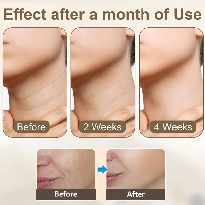 Facial%20Lifting%20Device%20EMS%20Neck%20Facial%20Eye%20Massage%20Face%20Slimmer%20Skin%20Tighten%20Wrinkle%20Anti%20Aging%20Face%20Massager%20Double%20Chin%20Remover%20-%20Image%205