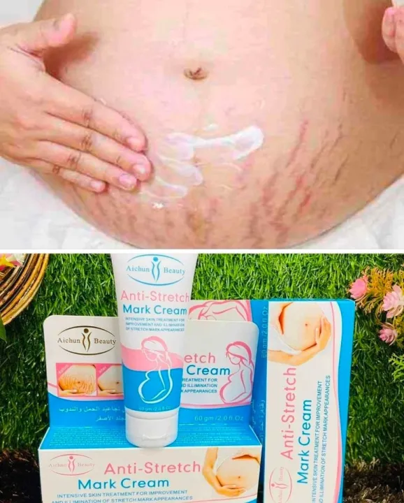 Stretch Marks Cream 60 G