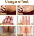 JAYSUING Private Label Therapy Drops Serum Knee Elbow Finger Joint Brightening Darkening Treatment Skin Care Serum-10ml. 