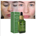 Breylee Acne Treatment Serum Facial - 17 ml. 