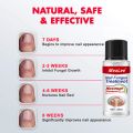 Nail Fungus Treatment 7 Day Repair Potion Essence Anti Infective Onychomycosis Nail Fungus Removal Gel Foot Care. 