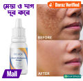 EELHOE Anti Melasma Drops – Brightening & Dark Spot Correcting Serum.