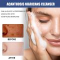 50ml Whitening Facial Cleanser Amino Acid Foam Scrub Cleansing Anti-Acne Oil Control Blackhead Remover Moisturizing Brightening. 