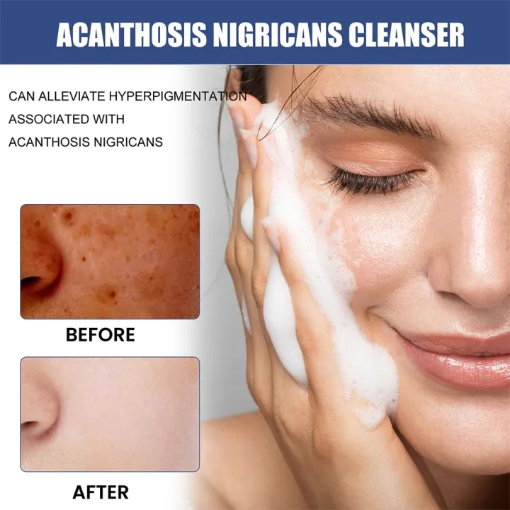 50ml%20Whitening%20Facial%20Cleanser%20Amino%20Acid%20Foam%20Scrub%20Cleansing%20Anti-Acne%20Oil%20Control%20Blackhead%20Remover%20Moisturizing%20Brightening%20-%20Image%204