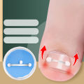 Ingrown Toenail Corrector Tools Pedicure Recover Embed Toe Nail Treatment Professional Ingrown Toenail Correction Foot Care Tool MIRRORRR. 