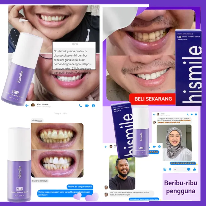Hismile%20v34%20Purple%20Teeth%20Whitening%20Toothpaste%20-%20Image%207
