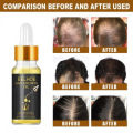 EELHOE Hair Growth Oil-20ml. 