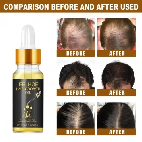 EELHOE%20Hair%20Growth%20Oil-20ml%20-%20Image%202