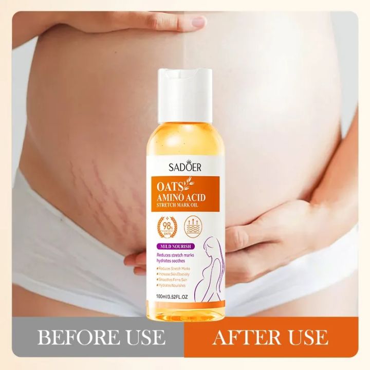 SADOER 98% Amino Acid Oats Essential Oil Fade Remove Stretch Mark Repair Smooth Massage Oil Serum for Pregnant Woman Skin Care - 15ml