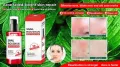 SNAIL ROUSHUN MIRACLE REPAIR SERUM 50ml. 