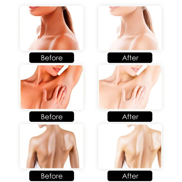 Whitening%20Soap%20for%20Dark%20Skin%20Bleaching%20Reduce%20Black%20Spots%20Melasma%20Deep%20Cleansing%20Moisturizing%20Lighten%20Vitamin%20C%20Brightening%20Soap%20-%20Image%203