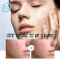 Effective Facial Redness Repair Cream Rosacea Treat Sensitive Skin Dryness Moisturizer Hydrating Sooth Lotion Korean Cosmetics.