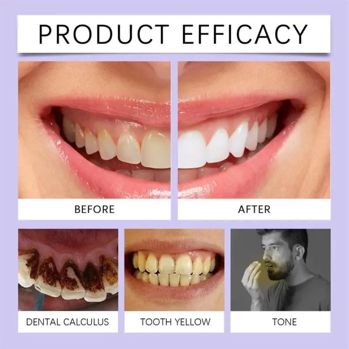 ELHOE%20Teeth%20Whitening%20Toothpaste%20%E2%80%93%20100%25%20Natural%20Herbal%20Formula%20%E2%80%93%20Instantly%20Whitens%20Teeth,%20Removes%20Yellow%20Stains,%20Fights%20Plaque%20&%20Bad%20Breath%20%E2%80%93%20Strengthens%20Enamel%20%E2%80%93%20Fluoride-Free%20&%20Safe%20for%20Sensitive%20Gums%20%E2%80%93%20Daily%20Oral%20Care%20Toothpaste%20for%20Men%20&%20Women%20-%20Image%203