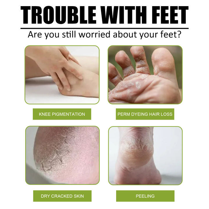 120ml%20Foot%20Exfoliator%20Softener%20100ml%20Foot%20Spray%206%20Seconds%20Remove%20Dead%20Skin%20Calluses%20Anti-Cracked%20Heel%20Enhancer%20Nail%20Pedicure%20-%20Image%204