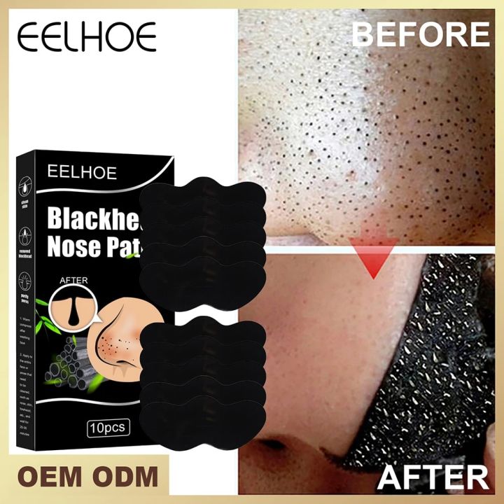 10pcs%20Nose%20Blackhead%20Remover%20Mask%20Skin%20Deep%20Cleansing%20Shrink%20Pore%20Nose%20Black%20Head%20Remove%20Stickers%20Skin%20Care%20Mask%20Patch%20AbandonA%20-%20Image%202