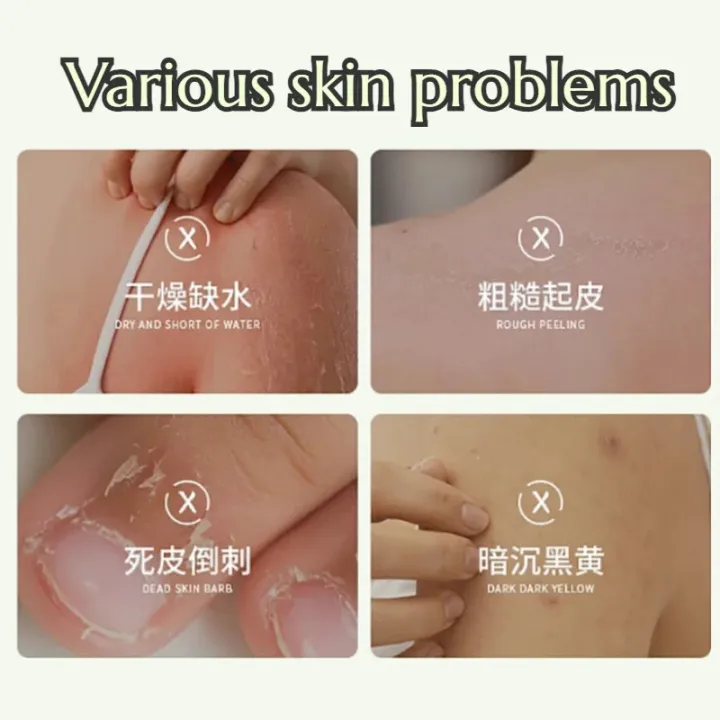 NIVEA%2050X%20Vitamin%20C&E%20Citrus%20VC%20Deep%20Nourishing%20Brightening%20Hydrating%20Body%20Lotion%20180g%20Skin%20Lightening%20Cream%20for%20Dark%20Skin%20-%20Image%203