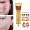 LANBENA TCM scar and Acne Spot Removal Gel Ointment. 