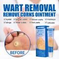 【Best value for money】 New 1 Foot Care Medical Corn Removal Pad Wart Thorn Curative Cream Callue Calloity Wart Ointment Treatment Againt Mole kin. 