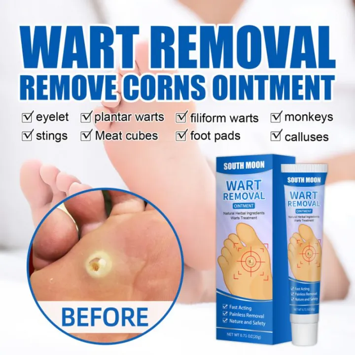 %E3%80%90Best%20value%20for%20money%E3%80%91%20New%201%20Foot%20Care%20Medical%20Corn%20Removal%20Pad%20Wart%20Thorn%20Curative%20Cream%20Callue%20Calloity%20Wart%20Ointment%20Treatment%20Againt%20Mole%20kin%20-%20Image%206