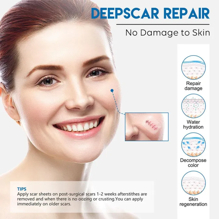 Efficient%20Surgery%20Scar%20Removal%20Silicone%20Gel%20Tape%20Sticker%20Sheet%20Repair%20Blemish%20Scar%20Breathable%20Patches%20Patch%20Waterproof%20Ther%20G5X9%20-%20Image%204