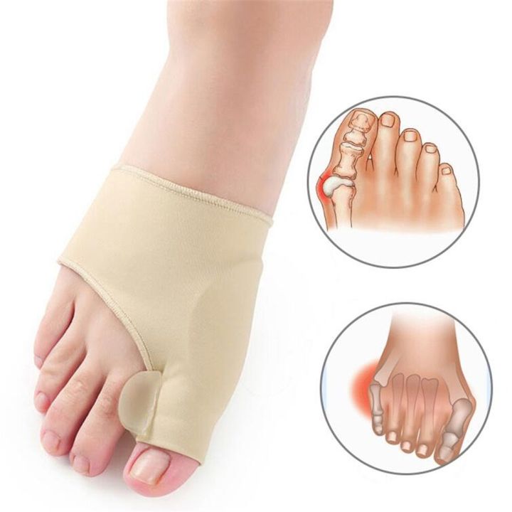 1Pair%20Bunion%20Corrector%20Toe%20Separator%20Hallus%20Valgus%20Pain%20Relief%20Foot%20Care%20Elastic%20Fabric%20Gel%20Straightener%20Toe%20Corrector%20Tool%20-%20Image%202