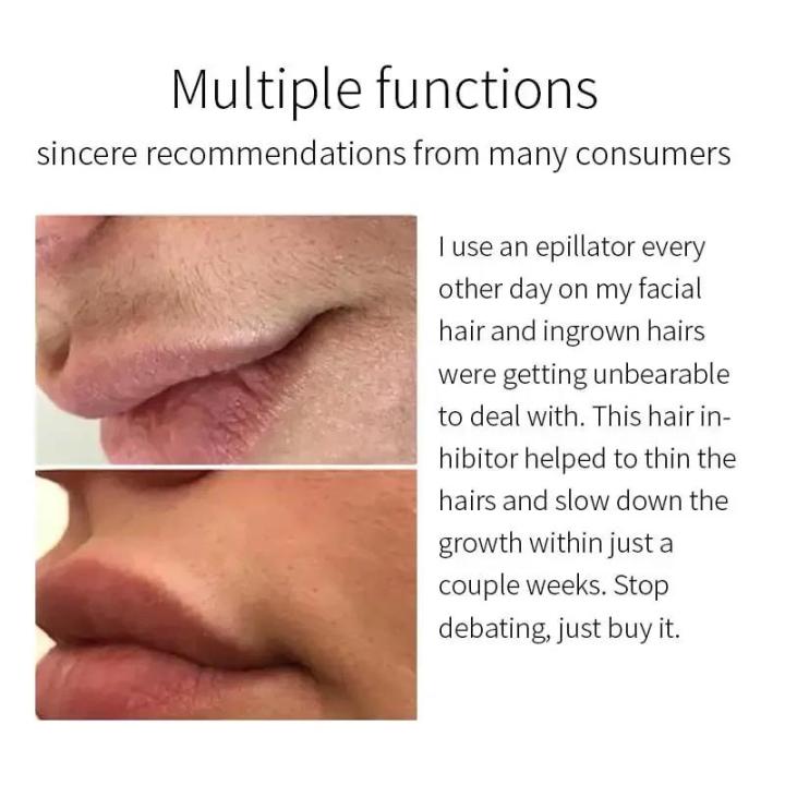 Permanent%20Hair%20Removal%20Cream%20Facial%20Hair%20Remover%20Depilatory%20Painless%20for%20Beard%20Armpit%20Body%20Persistent%20Inhibition%20of%20Hair%20Growth%20-%20Image%202