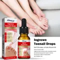 South Moon Inner Toenail Repair Serum, Nail Repair Nail Care, Nail Care, Essential Oils, Cleanse and Remove Nail Fungus. 