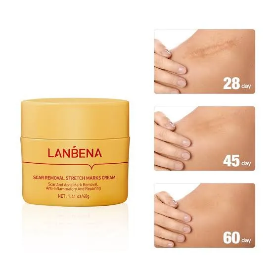 LANBENA%20Scar%20Remover%20Cream%20Repair%20Serum%20Stretch%20Mark%20Blackhead%20Acne%20Spots%20TCM%20Removal%20Gel%20Whitening%20Face%20Body%20Essence-40GM%20-%20Image%203