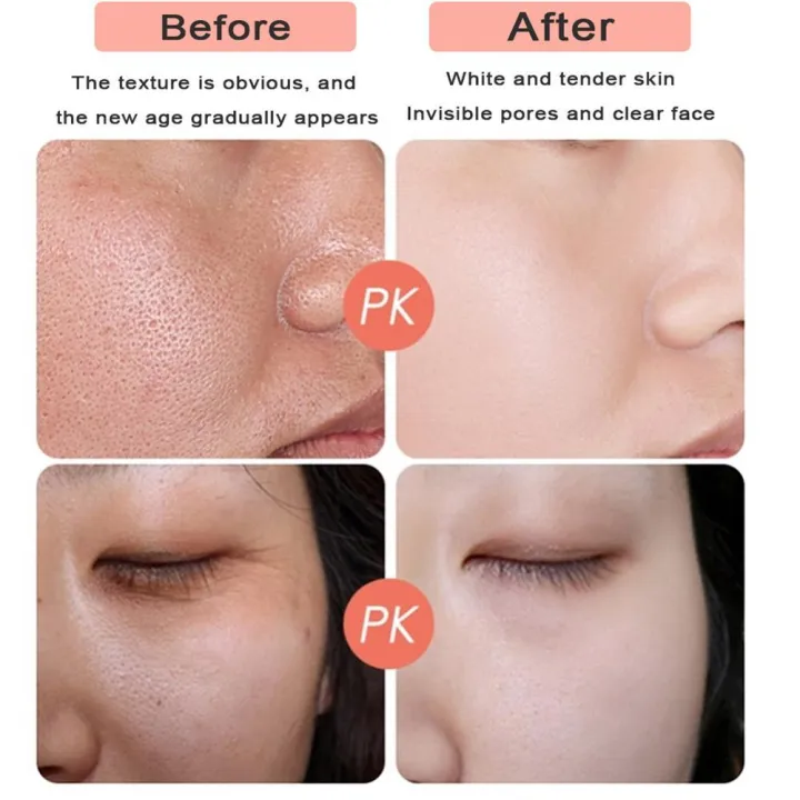 1PC%2024K%20Gold%20Face%20Cream%20Firming%20Face%20Cream%20Lifting%20Neck%20Anti-Aging%20Remove%20Wrinkles%20Night%20Day%20Moisturizer%2050/30/20g%20Oil%20Contral%20-%20Image%205