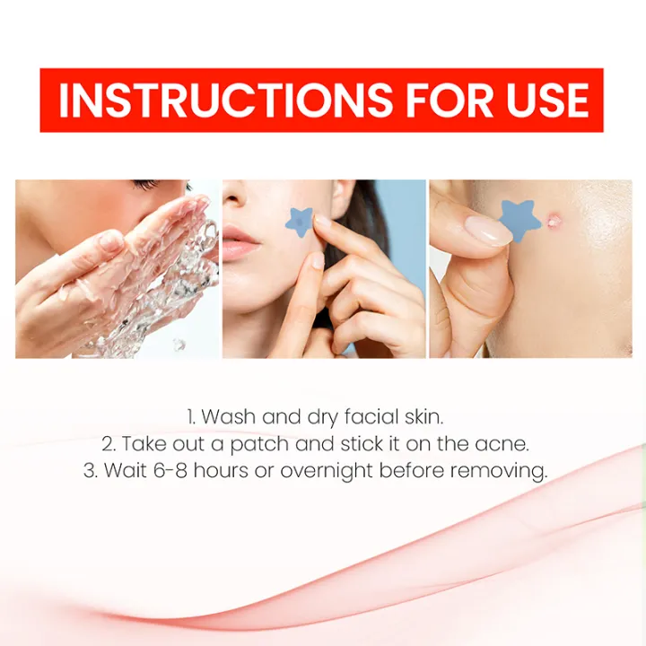 200Pcs%20Invisible%20Acne%20Removal%20Pimple%20Patch%20Beauty%20Acne%20Tool%20Colorful%20Pimple%20Acne%20Mask%20Concealer%20Face%20Spot%20Scar%20Care%20Sticker%20-%20Image%205
