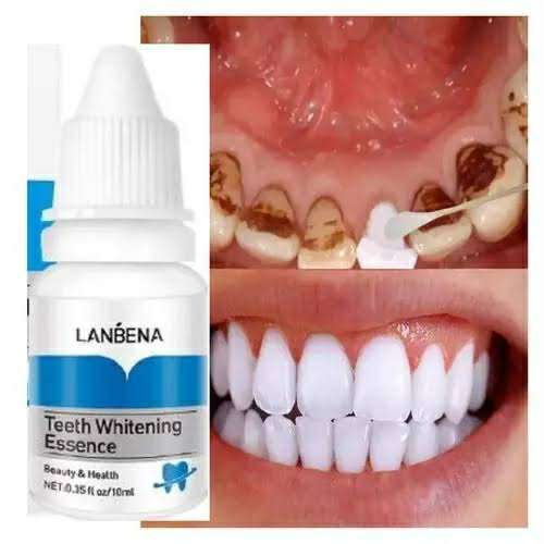 Lanbena%20Teeth%20Whitening%20Essence%2010ml%20%5BGrab%20Cosmic%20House%5D%20-%20Image%207