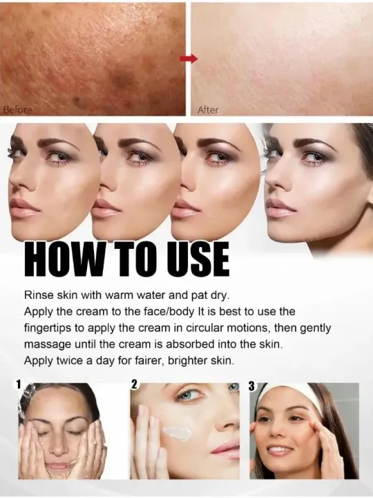Face%20Chloasma%20Removal%20Cream%20For%20Women%20Remove%20Melasma%20Brighten%20Cream%20Facial%20Fade%20Dull%20Brightening%20Cream%20Dark%20Skin%20Lightening%20Care%20-%20Image%206