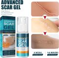 Advanced Scar Removal Gel, Scar Gel for Surgical Scars, Acne Scar Treatment for Face, Acne Scars and Dark Spaot Remover, Resurfacing Scar Gel, Gentle Skin Care for Acne Prone Skin (1PC. 