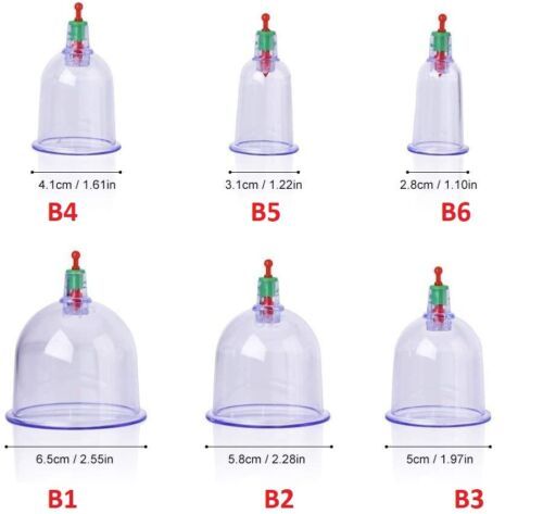 ABS%20Glass%20Hijama%20Loose%20Cup%20-%20Size%20B2,%20For%20Clinical%205pcs%20-%20Image%203