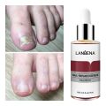 LANBENA Nail Repair Essence Serum Fungal Nail Treatment 12ml. 