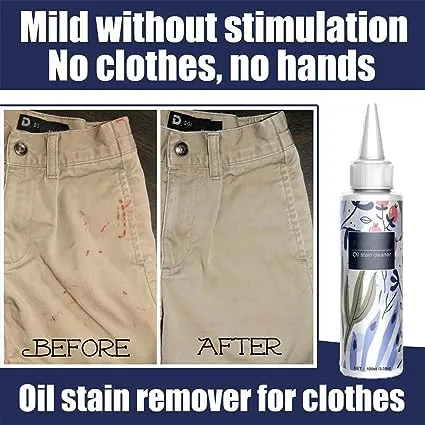 100ml%20Laundry%20Stain%20Remover%20-%20White%20Shirt%20Guardian,%20Laundry%20Stain%20Remover,%20Garment%20Stubborn%20Stain%20Cleaner%20Oil%20Remover%20-%20Image%202