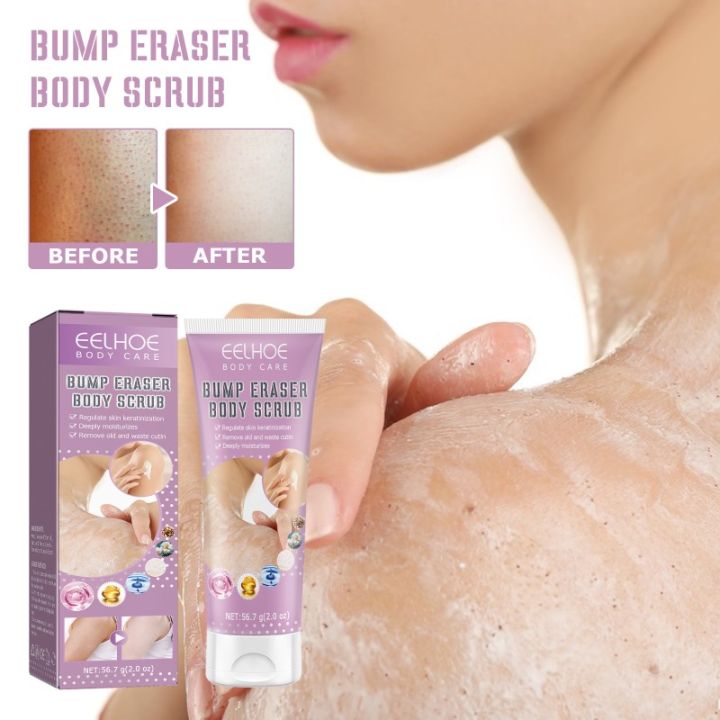 Keratosis%20Pilaris%20Removal%20Cream%20for%20Strawberry%20Legs%20Hydrating,%20moisturizing,%20deep%20cleansing%20rough%20body%20skin%20exfoliating%20scrub%20-%20Image%202
