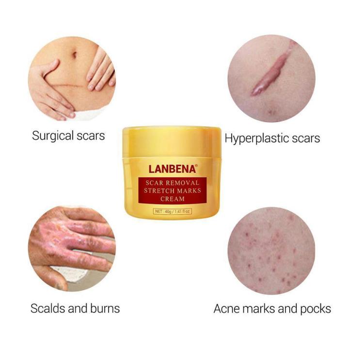LANBENA%20Scar%20Removal%20Cream%2040g%20-%20Image%202