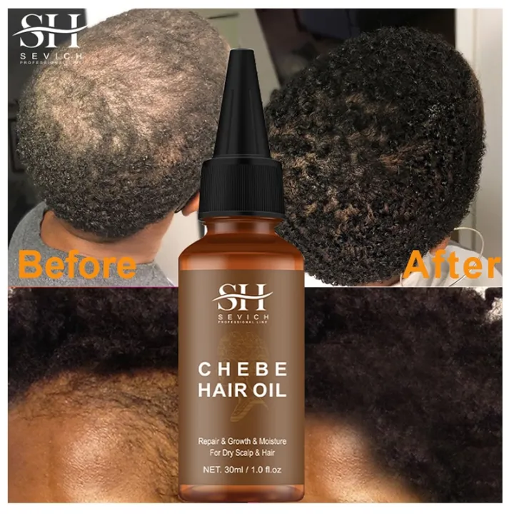 Fast%20Hair%20Growth%20Oil%20African%20Crazy%20Traction%20Alopecia%20Chebe%20Hair%20Mask%20Anti%20Hair%20Break%20Hair%20Strengthener%20Hair%20Loss%20Treatment%20Spray%20-%20Image%206