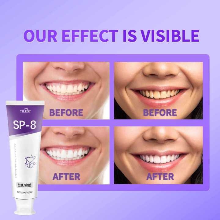 SP-8%20toothpaste,%20teeth%20whitening,%20yellowing,%20stain%20removal,%20heat%20protection,%20gum%20protection,%20tooth%20freshening,%20SP-8%20toothpaste%20120g%20-%20Image%203