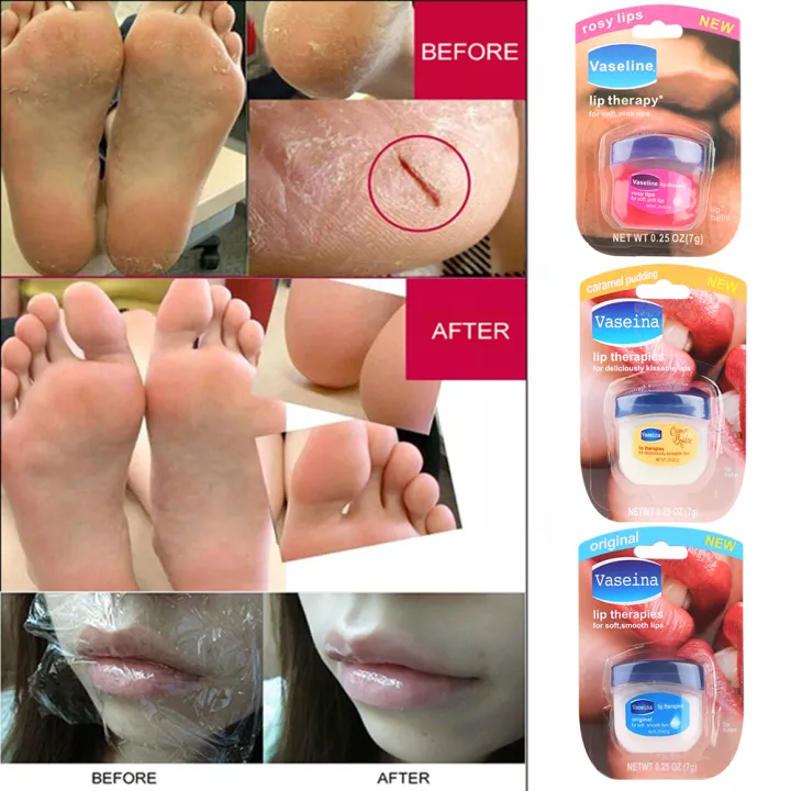 Pure%20Vaseline%20Moisturizing%20Lip%20Balm%20Cream%20For%20Body%20And%20Skin%20Care%20Anti-Cracking%20Natural%20Plant%20Organic%20Lipbalm%20Korean%20Cosmetics%20Lateil%20-%20Image%206