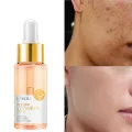 LAIKOU Natural Vitamin C Serum Brighten Face Skin Care Fade Dark Spots Freckle Anti-Aging Whitening Serum Skin Care Essence -17ml.