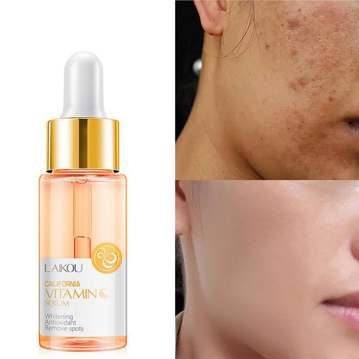 LAIKOU Natural Vitamin C Serum Brighten Face Skin Care Fade Dark Spots Freckle Anti-Aging Whitening Serum Skin Care Essence -17ml