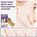 Eelhoe Silicone Scar Patch Fade Pregnancy Cesarean Surgery Scar Hyperplasia Silicone Repair Mask. 