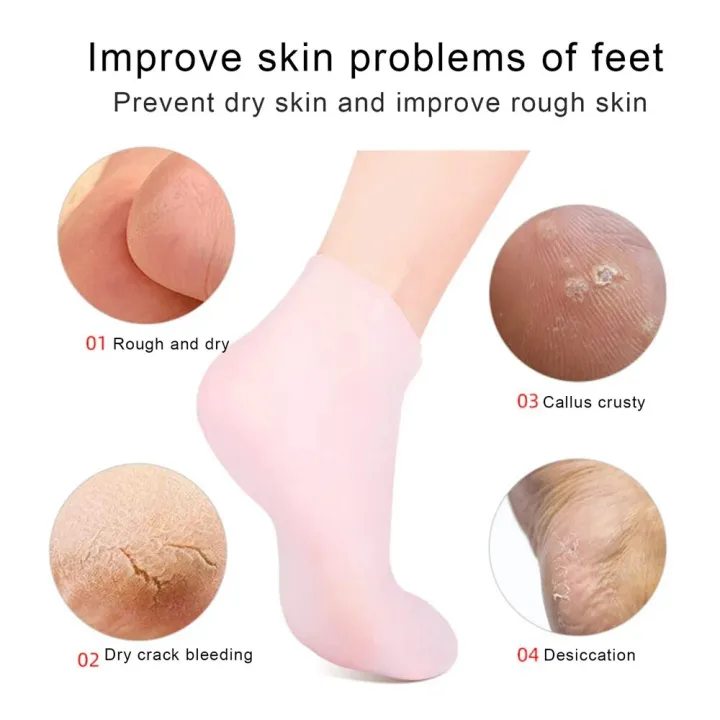 1Pair%20Silicone%20Socks%20for%20Women,Moisturizing%20Foot%20Socks,Soft%20Gel%20Socks,Aloe%20Socks,Women%20Spa%20Pedicure%20Socks%20for%20Repairing%20Dry%20Feet%20-%20Image%203