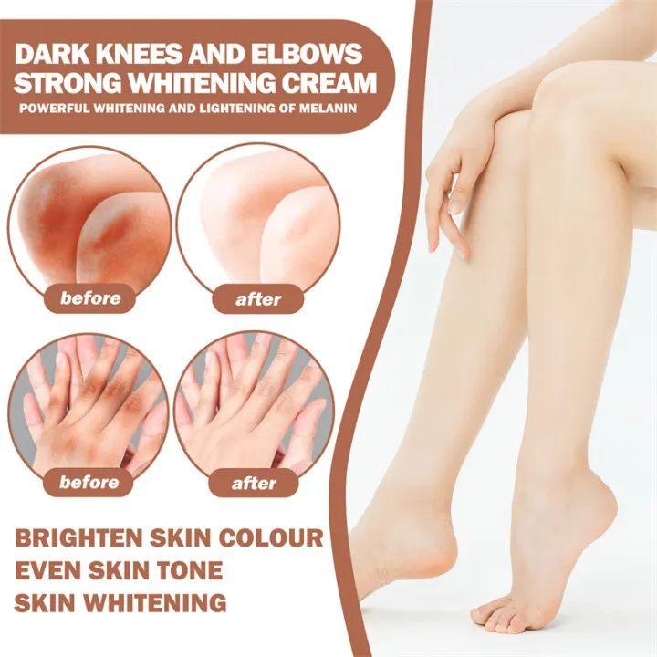 Body%20Whitening%20Cream%20Fast%20Bleach%20Private%20Parts%20Lighten%20Underarm%20Legs%20Knees%20Melanin%20Intimate%20Areas%20Remove%20Dark%20Spot%20Beauty%20Health%20-%20Image%204