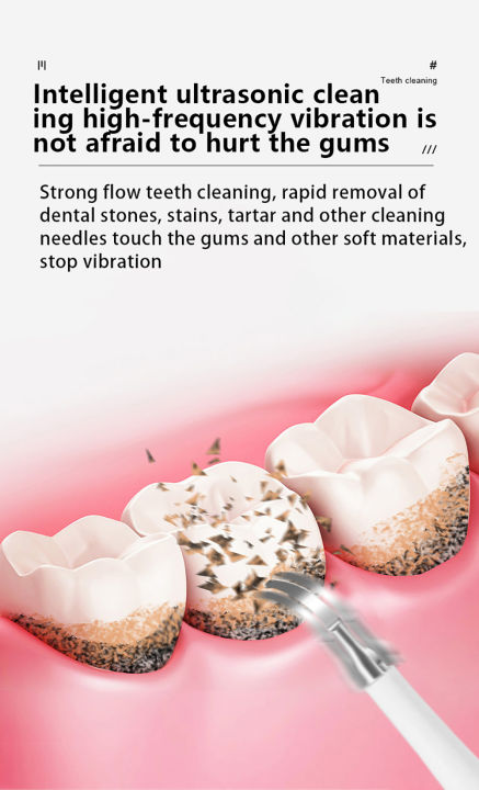 Hicare%20Electric%20Toothbrush,%20Ultrasonic%20Teeth%20Cleaner,%20Teeth%20Washer,%20Calculus%20Remover,%20Household%20Teeth%20Whitening%20Device,%20Blue%20-%20Image%203