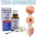 Duofilm Salicylic Acid and Lactic Acid Solution 15ml. 