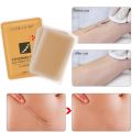 Instantly Tattoo Scar Cover Up Body Flaw Concealer Patches Skin Invisible Blemish Covering Sticker Waterproof Scar Treatment.