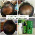 2PCS/SET Natural Thailand Neo Hair Lotion Hair Care Oil Hair Grow Serum Essential Hair Loss Treatment Product Hair Growth 120ML. 